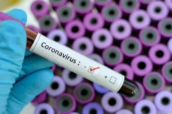 Covid-19: Angola regista mais três casos positivos de transmissão local