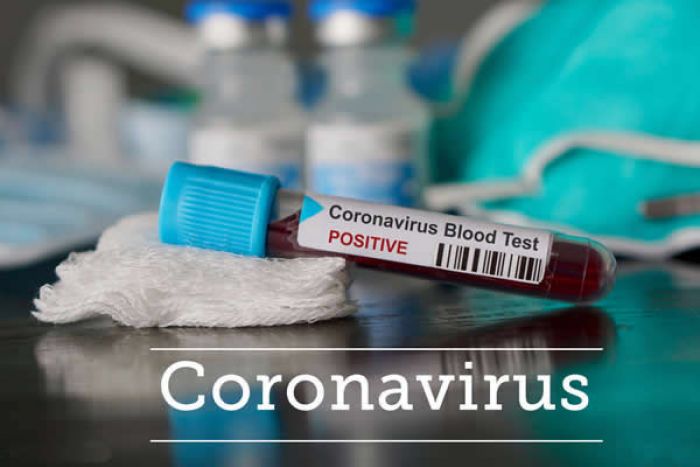 Covid-19: Angola regista quatro novos casos e totaliza 81 infetados